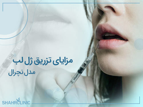 مزایای تزریق ژل لب مدل نچرال