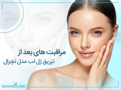 مراقبت های بعد از تزریق ژل لب مدل نچرال