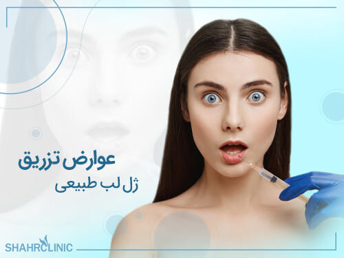 عوارض تزریق ژل لب طبیعی