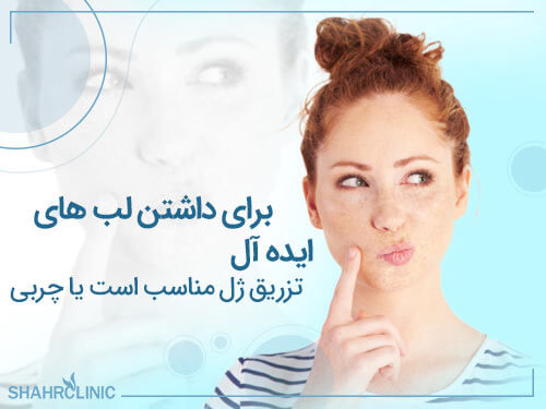 برای داشتن لب هایی ایده آل تزریق ژل مناسب است یا چربی؟
