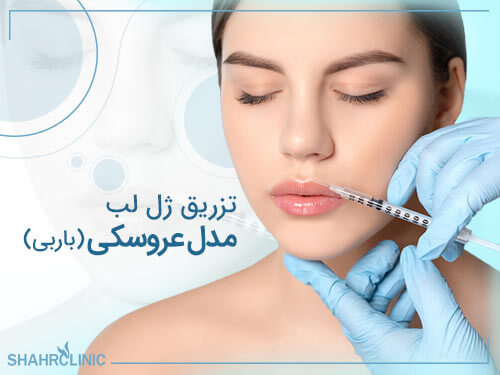 تزریق ژل لب مدل عروسکی یا باربی