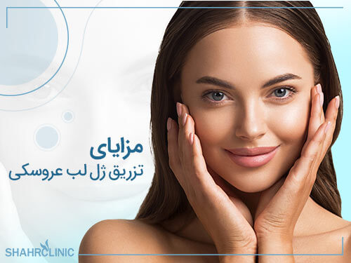 مزایای تزریق ژل لب عروسکی