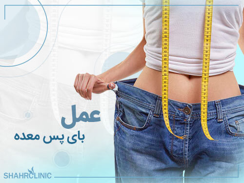 عمل بای پس معده