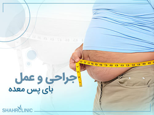 جراحی و عمل بای پس معده