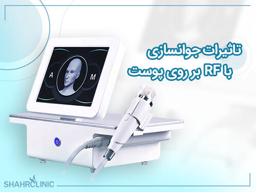 جوانسازی با آر اف فرکشنال