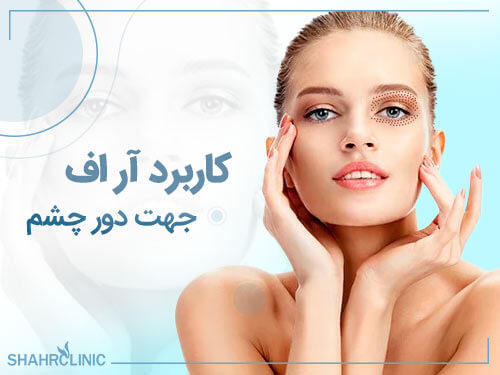 کاربرد آر اف دور چشم