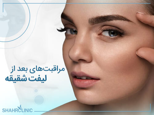 مراقبت‌های بعد از لیفت شقیقه