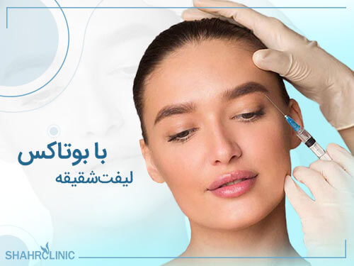 لیفت شقیقه با بوتاکس