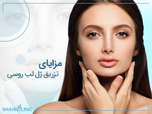 مزایای تزریق ژل لب روسی