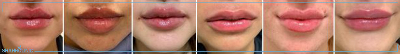 تصاویر مدل لب روسی