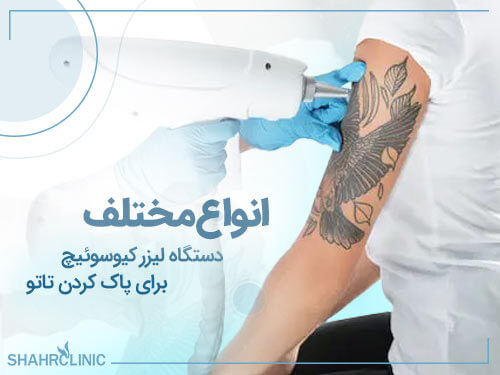 انواع مختلف دستگاه لیزر کیوسوئیچ برای پاک کردن تاتو