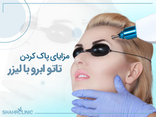 مزایای پاک کردن تاتو ابرو با لیزر