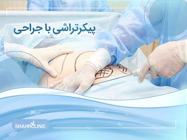 پیکرتراشی با جراحی