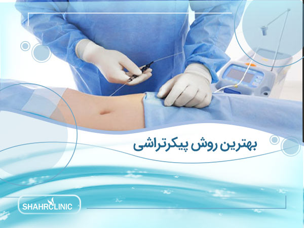 بهترین روش پیکرتراشی