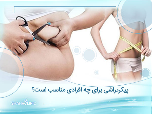 پیکرتراشی برای چه افرادی مناسب است