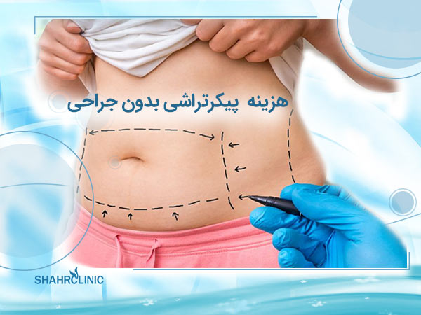 پیکرتراشی با جراحی