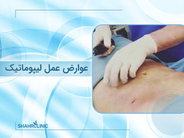 عوارض لیپوماتیک شکم و پهلو