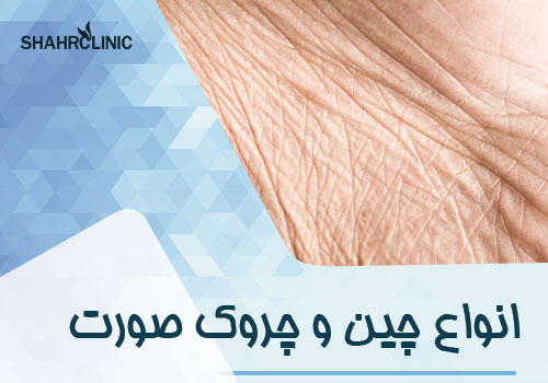 انواع چین و چروک صورت