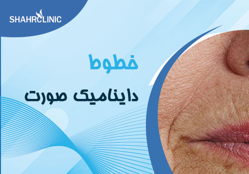 خطوط داینامیک صورت