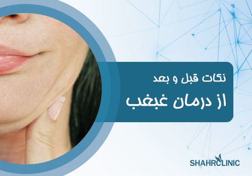 نکات قبل و بعد از درمان غبغب