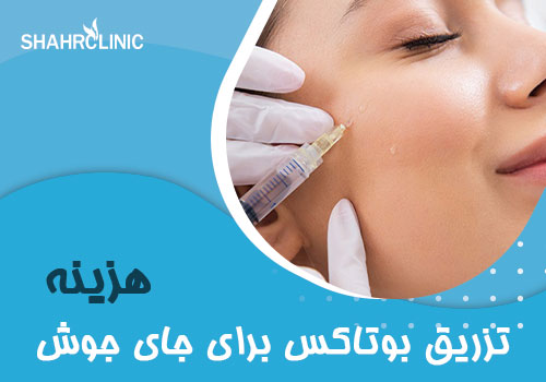 هزینه تزریق بوتاکس برای جای جوش