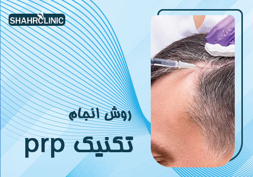 روش انجام تکنیک PRP