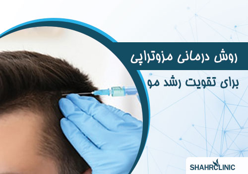 روش درمانی مزوتراپی برای تقویت رشد مو