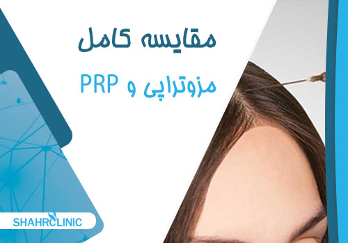 مزایای استفاده از تکنیک پی آر پی چیست؟