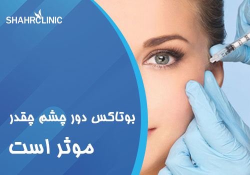 بوتاکس زیر چشم چقدر موثر است؟