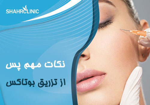 نکات مهم پس از تزریق بوتاکس