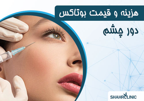 هزینه و قیمت بوتاکس دور چشم