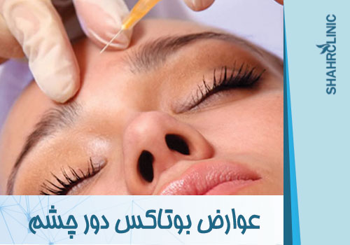 عوارض بوتاکس دور چشم
