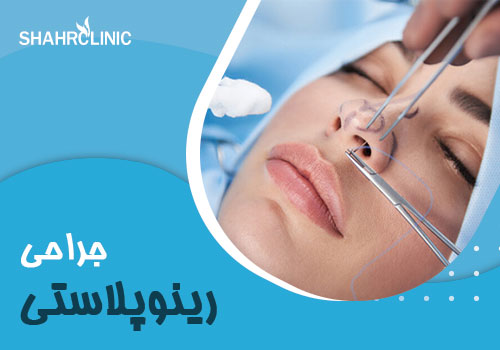 رینو پلاستی