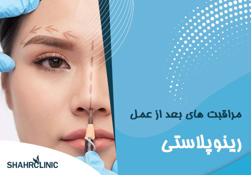 مراقبت‌های بعد از عمل رینوپلاستی شامل چه مواردی می‌شود؟