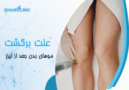 دلایل اصلی بازگشت مو بعد لیزر