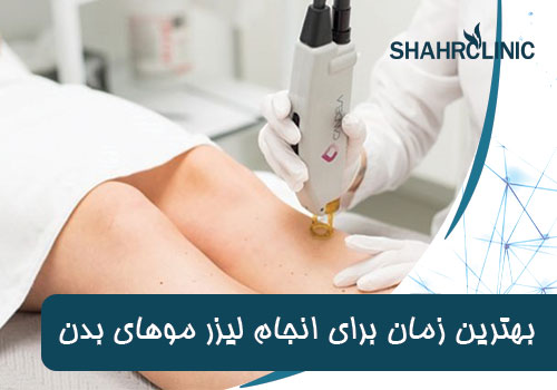 بهترین زمان برای انجام لیزر موهای بدن