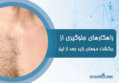 راهکارهای جلوگیری از برگشت موهای بدن بعد از لیزر