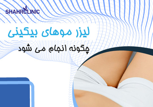 لیزر موهای زائد بیکینی چگونه انجام می‌شود؟