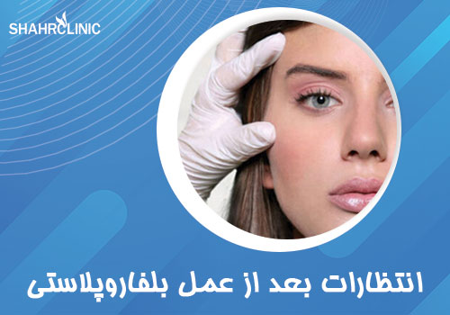 انتظاراتی که بلافاصله بعد از عمل بلفاروپلاستی می‌توان داشت؟