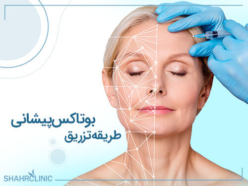 طریقه تزریق بوتاکس پیشانی
