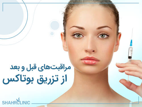 مراقبت های قبل و بعد از بوتاکس پیشانی
