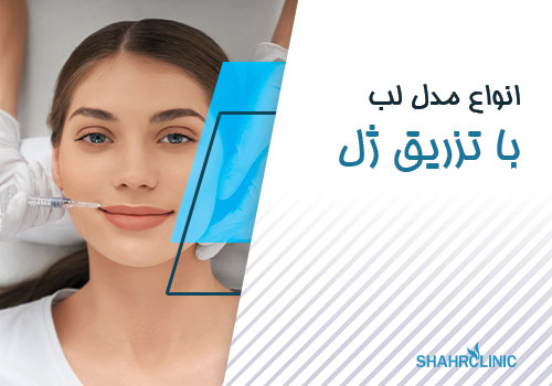 انواع مدل لب با تزریق ژل لب
