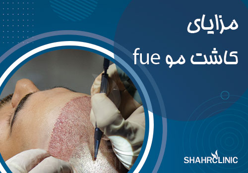 مزایای کاشت مو به روش اف یو ای