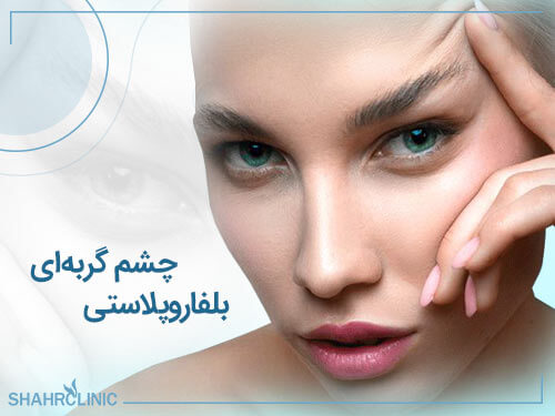 بلفاروپلاستی چشم گربه ای