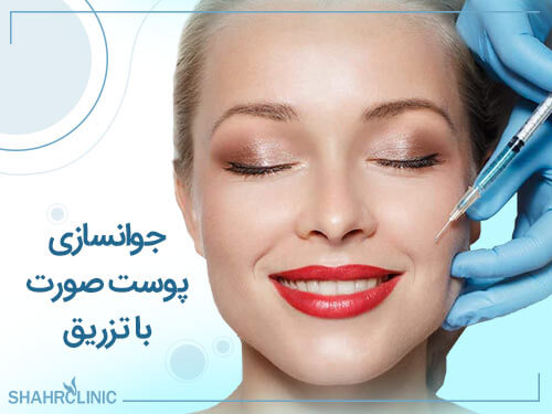 همه چیز راجع به جوانسازی پوست صورت با تزریق