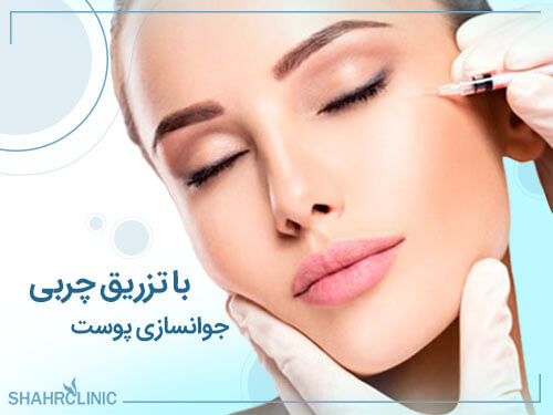 جوانسازی پوست با تزریق چربی