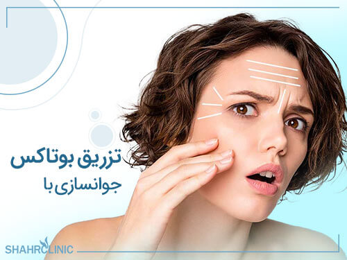 جوانسازی با تزریق بوتاکس