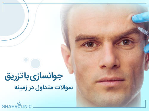 سوالات متداول در زمینه جوانسازی با تزریق