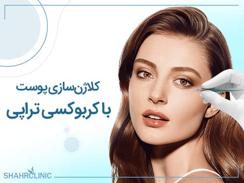 روشن کردن پوست صورت و بدن با کربوکسی تراپی