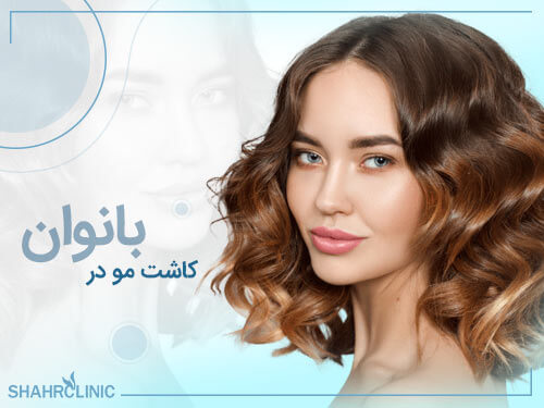 کاشت مو در بانوان